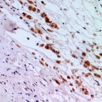 IFNAR2 antibody