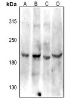 VEGFR2 Rabbit Polyclonal Antibody