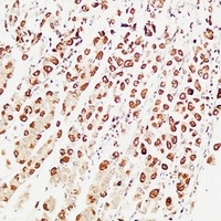 Anti-PS2 Antibody