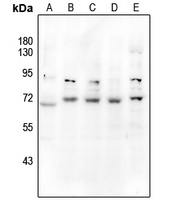 CD39 Rabbit Polyclonal Antibody