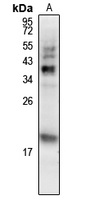 MCH Rabbit Polyclonal Antibody