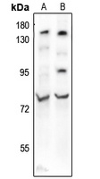 BMAL1 (Acetyl-K538) Rabbit Polyclonal Antibody