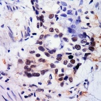 Anti-BMAL1 (Acetyl-K538) Antibody