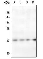 Histone H2A (Acetyl-K95) Rabbit Polyclonal Antibody
