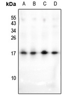 HMGN2 (Acetyl-K31) Rabbit Polyclonal Antibody