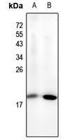 NF-E4 (Acetyl-K43) Rabbit Polyclonal Antibody