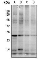 Cathepsin W Antibody