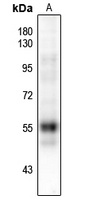 RUNX1 (Phospho-S249) Antibody