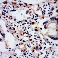 RUNX1 (Phospho-S249) Antibody