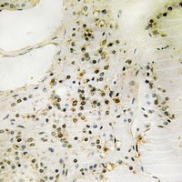 Anti-FOXO1/3 (Phospho-S322+S325/pS318+S321) Antibody