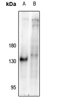 NFAT1 (Phospho-S326) Antibody