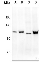 Progesterone Receptor (Phospho-S400) Antibody