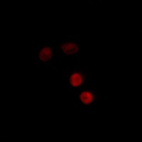 Progesterone Receptor (Phospho-S400) Antibody