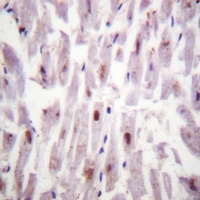 Anti-c-RAF (Phospho-S621) Antibody
