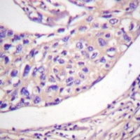 Anti-Thymidine Kinase 1 (Phospho-S13) Antibody