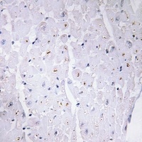 Anti-53BP1 (Phospho-S6) Antibody