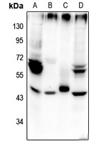 Beta-2 Adrenergic Receptor (Phospho-S355/S356) Antibody