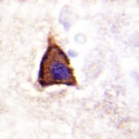 Beta-2 Adrenergic Receptor (pS355/S356) antibody