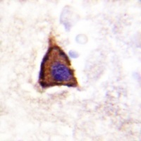 Beta-2 Adrenergic Receptor (Phospho-S355/S356) Antibody