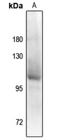 Androgen Receptor (Phospho-S94) Antibody