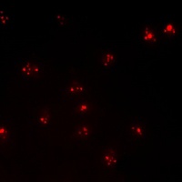 Androgen Receptor (Phospho-S94) Antibody