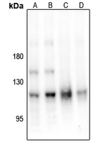PKC mu (Phospho-S205) Antibody