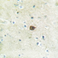 PKC mu (Phospho-S205) Antibody