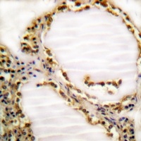 Anti-RB1 (Phospho-T821) Antibody