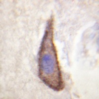 Anti-CD226 (Phospho-S329) Antibody