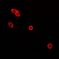 Anti-CD226 (Phospho-S329) Antibody