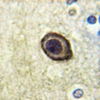 CD115 (Phospho-Y561) Antibody