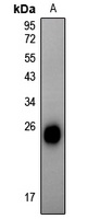 Alpha-crystallin B (Phospho-S59) Antibody