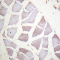 Alpha-crystallin B (Phospho-S59) Antibody