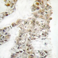 Anti-DNA-PKcs (Phospho-S2056) Antibody