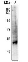 PPAR alpha (Phospho-S21) Antibody