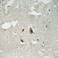 Anti-SMAD2 (Phospho-T220) Antibody