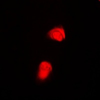Anti-SMAD2 (Phospho-T220) Antibody