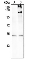 SMAD3 (Phospho-S208) Antibody