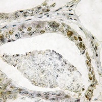 SMAD3 (Phospho-S208) Antibody