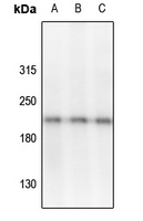 VEGFR2/3 (Phospho-Y1054/Y1063) Antibody