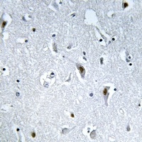 Anti-HMGN2 (Phospho-S29) Antibody