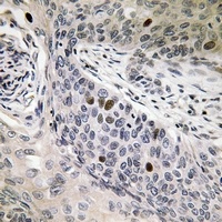 Anti-hnRNP D0 (Phospho-S83) Antibody
