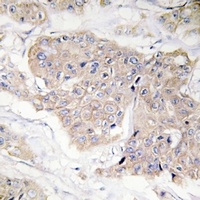 Anti-CD124 (Phospho-Y497) Antibody