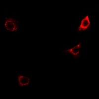 Anti-CD124 (Phospho-Y497) Antibody