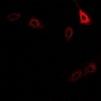 Anti-CD127 (Phospho-Y449) Antibody