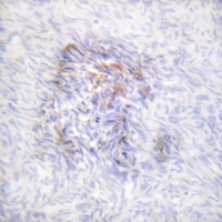 Anti-Aconitase 1 (Phospho-S138) Antibody