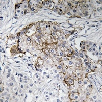 Beta-NaCH (pT615) antibody