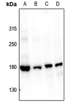 Topoisomerase 2 alpha (Phospho-S1106) Antibody