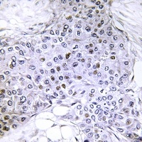 Topoisomerase 2 alpha (Phospho-S1106) Antibody