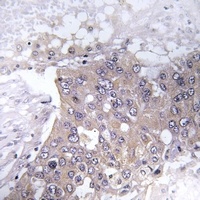 Anti-JAK2 (Phospho-Y221) Antibody